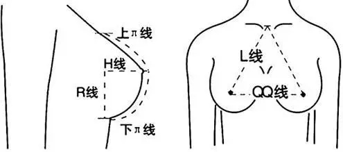 上海假体隆胸手术后会不会影响生活